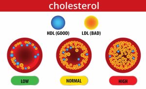 Don’t Ignore High Cholesterol or Blood Pressure: Early Detection Can Save Lives