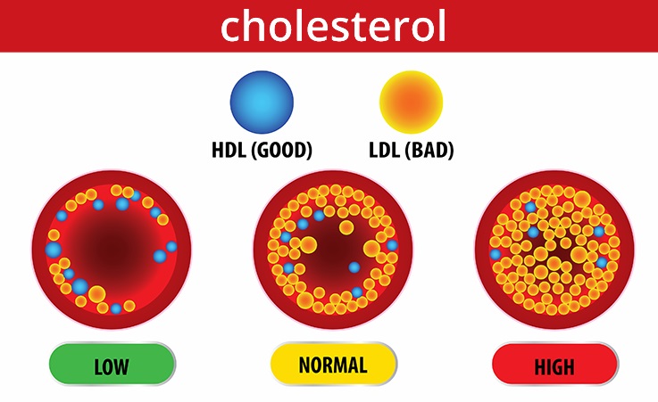 Don’t Ignore High Cholesterol or Blood Pressure: Early Detection Can Save Lives