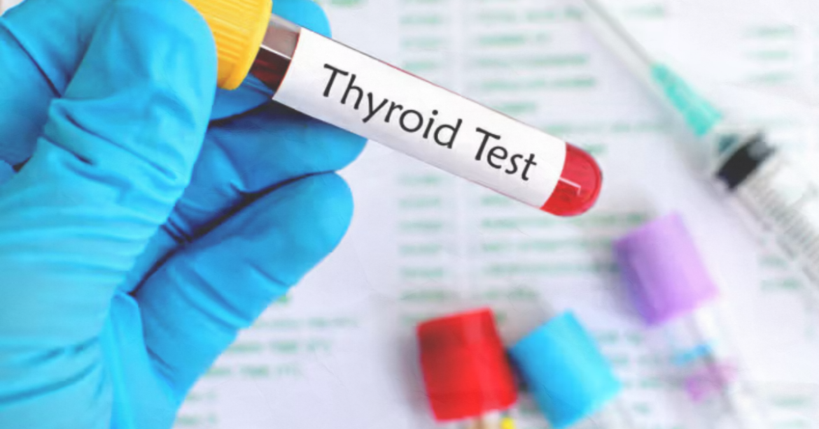 The Endocrine System Secret: How a Simple Thyroid Test Can Explain Your Weight Gain and Mood Swings